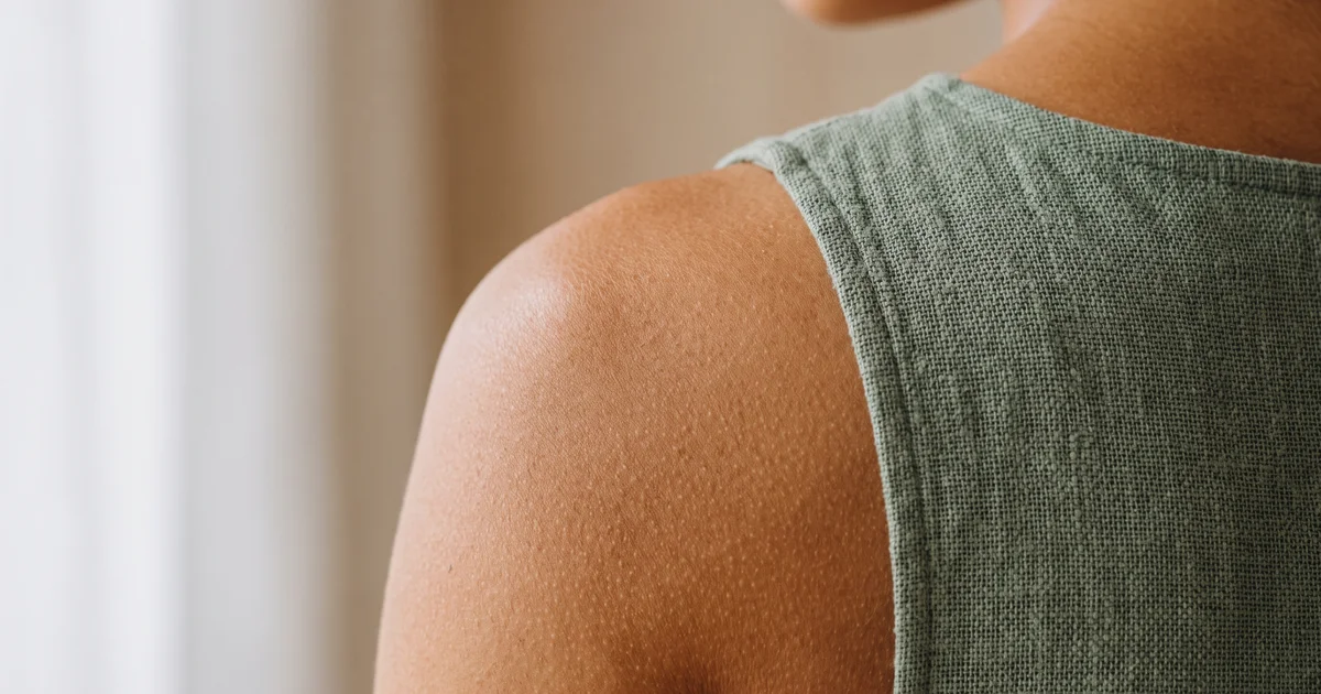 Sommer: Wie Botox gegen Schwitzen hilft